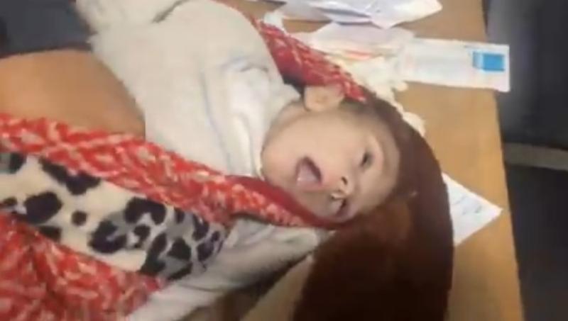 بالفيديو.. مشاهد قاسية لطفل يصارع الموت بسبب جرائم الاحتلال الصهيوني