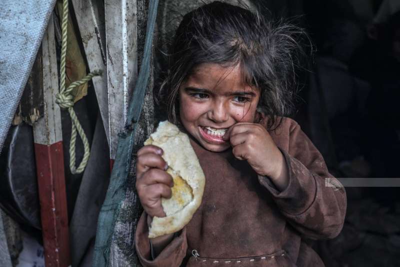 ”الأونروا”: أكثر من 50 ألف طفل في غزة يحتاجون للعلاج من سوء التغذية الحاد