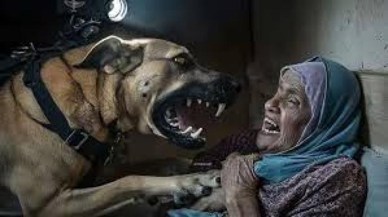 هجوم كلب بوليسي على سيدة فلسطينية 