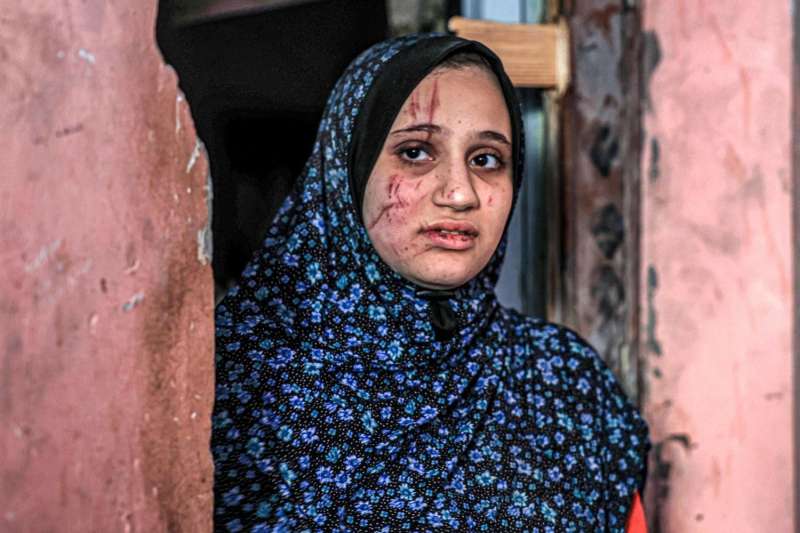 الصحة العالمية تحذر من انتشار الأمراض المعدية وانهيار المنظومة الصحية في غزة