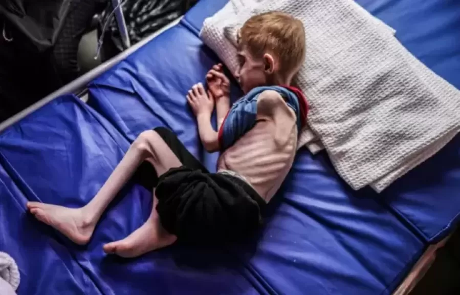الأونروا: على العالم أن يتحرك .. وأكثر من 50 ألف طفل قُتلوا أو أُصيبوا في غزة